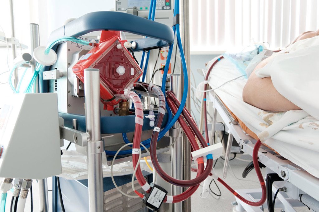 Theo dõi heparin không phân đoạn ở bệnh nhân trưởng thành đã từng sử dụng kỹ thuật Tim – phổi nhân tạo (ECMO): ACT, APTT hoặc ANTI-XA?