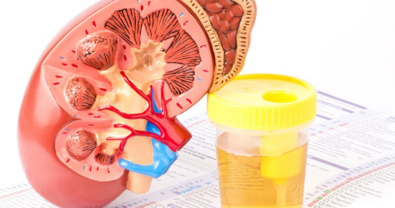 chẩn đoán và định hướng nguyên nhân protein niệu