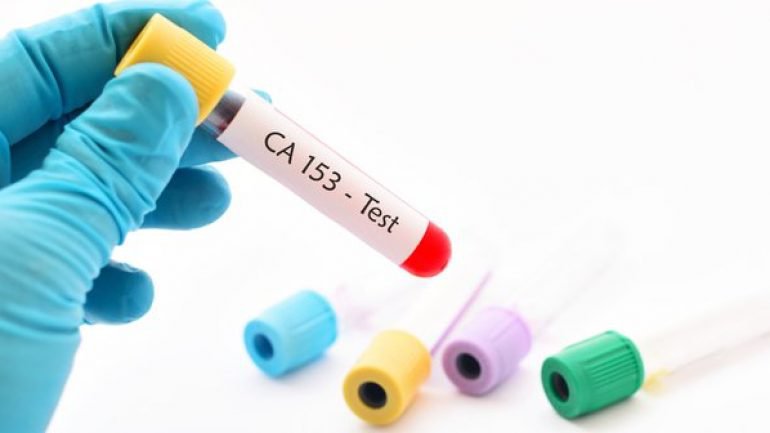 quy trình định lượng Ca 15-3