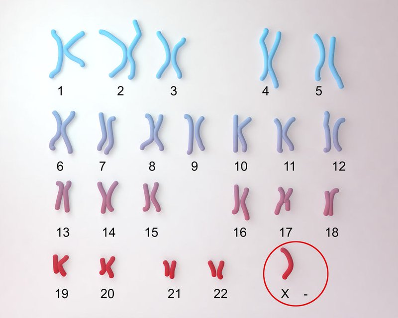 xét nghiệm chẩn đoán các thể lệch bội