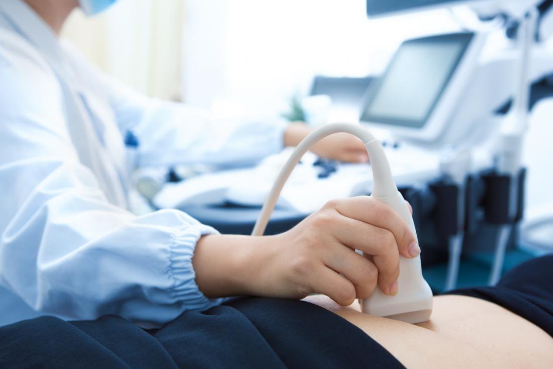 cắt túi mật bằng phương pháp nội soi
