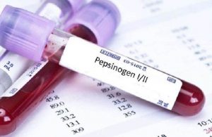 quy trình định lượng Pepsinogen II
